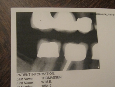 this is how the dentist sees me