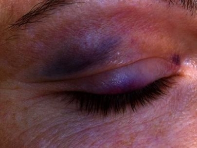 Oops... It did hurt a little :)