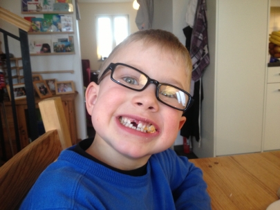 Out comes the tooth fairy