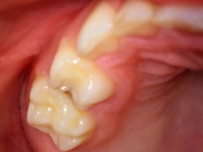 soon to the dentist!